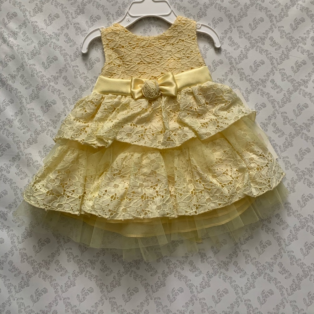 Baby Yellow Dress